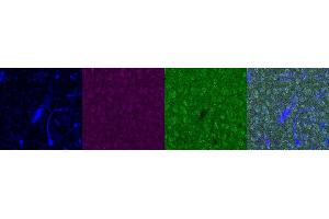 Immunohistochemistry (IHC) image for anti-Insulin-Like Growth Factor Binding Protein 6 (IGFBP6) antibody (ABIN7455987)