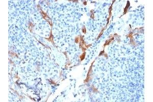 Formalin-fixed, paraffin-embedded human Tonsil stained with Cytokeratin 16 Mouse Recombinant Monoclonal Antibody (KRT16/1714). (Recombinant KRT16 anticorps  (C-Term))