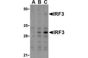 Western blot analysis of IRF3 in U937 whole cell lysate with AP30448PU-N IRF3 antibody at (A) 1, (B) 2, and (C) 4 μg/ml. (IRF3 anticorps  (Intermediate Domain))