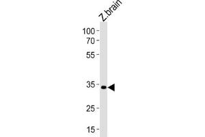 Western Blotting (WB) image for anti-Paired Box Gene 2a (PAX2A) antibody (ABIN3004629) (PAX2A anticorps)