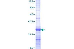EXOSC2 Protein (AA 71-160) (GST tag)