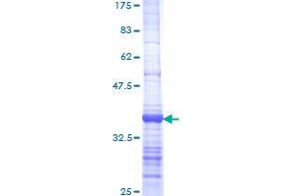 EXOSC2 Protein (AA 71-160) (GST tag)