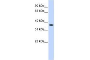Image no. 1 for anti-Zinc Finger Protein 444 (ZNF444) (AA 108-157) antibody (ABIN6740452) (ZNF444 anticorps  (AA 108-157))