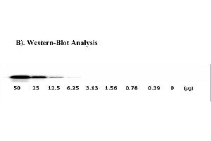 Image no. 3 for Met Proto-Oncogene (MET) ELISA Kit (ABIN625241)