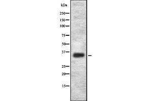 Western blot analysis OR2L2 using HepG2 whole cell lysates (OR2L2 anticorps)