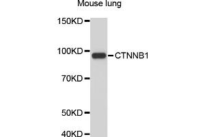 Western blot analysis of extracts of mouse lung, using CTNNB1 antibody (ABIN4903405). (CTNNB1 anticorps)