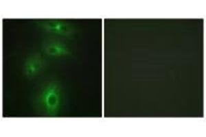 Immunofluorescence analysis of HeLa cells, using TMPRSS3 antibody. (TMPRSS3 anticorps  (C-Term))