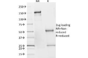 SDS-PAGE Analysis of Purified SDHB Mouse Monoclonal Antibody (SDHB/2382). (SDHB anticorps  (AA 165-273))