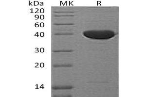 Western Blotting (WB) image for serpin Peptidase Inhibitor, Clade F (Alpha-2 Antiplasmin, Pigment Epithelium Derived Factor), Member 1 (SERPINF1) protein (ABIN7320733)