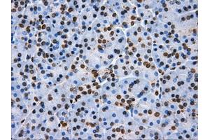 Image no. 1 for anti-ATP Synthase, H+ Transporting, Mitochondrial F1 Complex, beta Polypeptide (ATP5B) antibody (ABIN1496766)