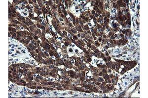 Image no. 6 for anti-CCR4-NOT Transcription Complex Subunit 4 (CNOT4) (AA 190-455) antibody (ABIN1491098) (CNOT4 anticorps  (AA 190-455))