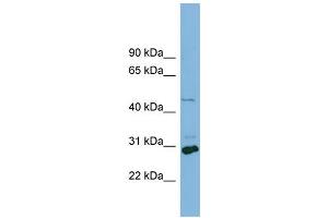 WB Suggested Anti-SLC16A1  Antibody Titration: 0.