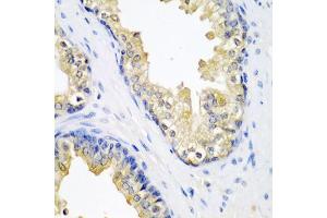 Immunohistochemistry of paraffin-embedded human prostate using SPINT2 antibody. (SPINT2 anticorps)