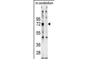 Western blot analysis of anti-Ubiquilin1 Antibody (N-term) (ABIN388965 and ABIN2837880) pre-incubated with and without blocking peptide (BP2176a) in Jurkat cell line lysate. (Ubiquilin 1 anticorps  (N-Term))