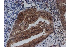 Image no. 6 for anti-Spermidine/Spermine N1-Acetyltransferase 2 (SAT2) antibody (ABIN1500807)