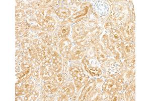 Immunohistochemistry (IHC) image for anti-Ribosomal Protein L7 (RPL7) (C-Term) antibody (ABIN7453643) (RPL7 anticorps  (C-Term))