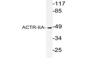 Western blot (WB) analyzes of ACTR-IIA antibody in extracts from rat kidney cells.
