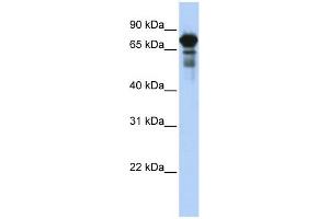 WB Suggested Anti-TRIM29 Antibody Titration:  0. (TRIM29 anticorps  (Middle Region))