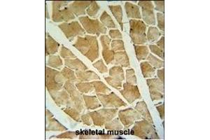 ARHG antibody (Center) 695b immunohistochemistry analysis in formalin fixed and paraffin embedded human skeletal muscle followed by peroxidase conjugation of the secondary antibody and DAB staining. (ARHGAP10 anticorps  (AA 237-263))