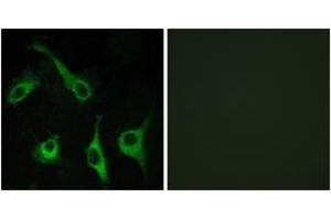 Immunofluorescence analysis of COS7 cells, using EDG1 Antibody. (S1PR1 anticorps  (AA 5-54))