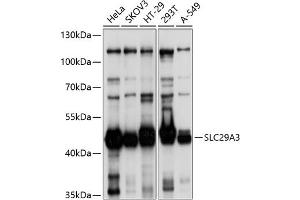 Western blot analysis of extracts of various cell lines, using SLC29 antibody (ABIN6132901, ABIN6147951, ABIN6147952 and ABIN6214611) at 1:1000 dilution.