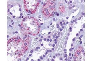 Anti-TAAR8 antibody IHC of human kidney, renal tubules.