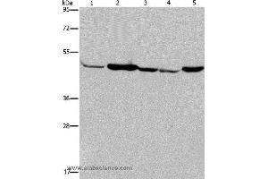 Western blot analysis of Human fetal muscle tissue, Jurkat and 293T cell, Hela cell and mouse liver tissue, using IDH2 Polyclonal Antibody at dilution of 1:600 (IDH2 anticorps)