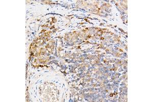 Immunohistochemistry of paraffin-embedded mouse brain using IFN Rabbit pAb (ABIN7267947) at dilution of 1:100 (40x lens).