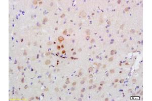 Formalin-fixed and paraffin embedded rat brain labeled with Rabbit Anti PRKAA2/AMPK alpha 2 Polyclonal Antibody, Unconjugated (ABIN680458) at 1:200 followed by conjugation to the secondary antibody and DAB staining
