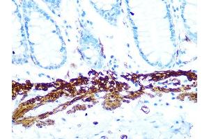 Immunohistochemistry of paraffin-embedded human colon using AMPKβ1 Rabbit mAb (ABIN7269654) at dilution of 1:100 (40x lens).