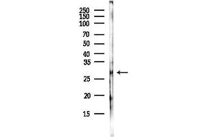 anti-H1 Histone Family, Member N, Testis-Specific (H1FNT) antibody