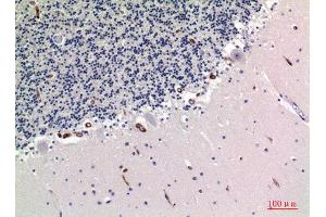 Immunohistochemistry (IHC) analysis of paraffin-embedded Human Brain, antibody was diluted at 1:100. (TRAFs and NIK-Associated Protein (TNAP) (Internal Region) anticorps)