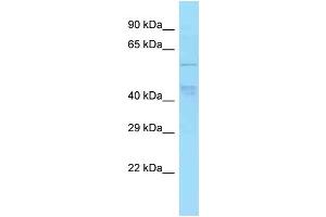 WB Suggested Anti-TBC1D22A Antibody Titration: 1. (TBC1D22A anticorps  (Middle Region))