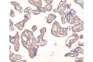 IHC analysis of ANGPT2 using anti-ANGPT2 antibody (ABIN3043725).