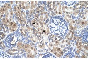 Human kidney (ARMCX6 anticorps  (N-Term))