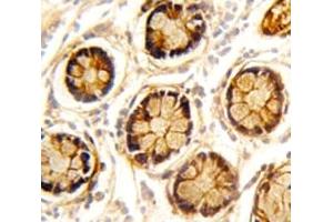 anti-Platelet-Derived Growth Factor Receptor-Like (PDGFRL) (AA 328-357) antibody