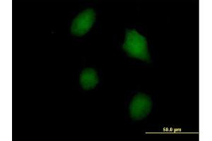 Immunofluorescence of purified MaxPab antibody to LGALS3 on HeLa cell. (Galectin 3 anticorps  (AA 1-250))