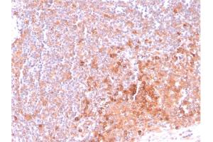 Formalin-fixed, paraffin-embedded human Tonsil stained with OX40 Mouse Monoclonal Antibody (OX40/3108).