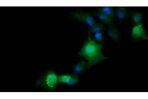 Image no. 6 for anti-ERG, ETS transcription factor (ERG) antibody (ABIN1498079) (ERG anticorps)