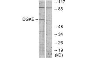 Western blot analysis of extracts from K562 cells, using DGKE Antibody. (DGKE anticorps  (AA 161-210))