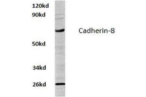 Image no. 1 for anti-Cadherin 8 (CDH8) antibody (ABIN317620) (Cadherin 8 anticorps)