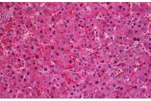 Human Liver: Formalin-Fixed, Paraffin-Embedded (FFPE) (SEC61A1 anticorps  (AA 463-476))