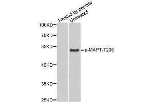 Western blot analysis of extracts from mouse brain tissue, using phospho-MAPT-T205 antibody (ABIN2987497). (MAPT anticorps  (pThr205))