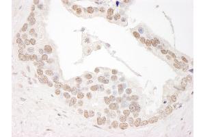 Immunohistochemistry (IHC) image for anti-Cyclin L1 (CCNL1) (AA 350-400) antibody (ABIN7454429)