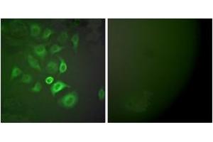 Immunofluorescence analysis of A549 cells, using S100 A1 Antibody.