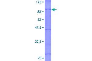 Image no. 1 for Eukaryotic Translation Initiation Factor 4 Gamma, 1 (EIF4G1) (AA 1-645) protein (GST tag) (ABIN1352615)