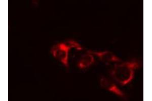 ABIN6274443 staining COLO205 cells by IF/ICC. (EPS8-Like 1 anticorps  (Internal Region))