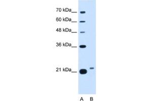 Western Blotting (WB) image for anti-LOC400856 (LOC400856) antibody (ABIN2462913) (LOC400856 anticorps)