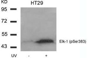Image no. 1 for anti-ELK1, Member of ETS Oncogene Family (ELK1) (pSer383) antibody (ABIN196614) (ELK1 anticorps  (pSer383))