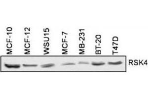 Western Blotting (WB) image for anti-Ribosomal Protein S6 Kinase, 90kDa, Polypeptide 6 (RPS6KA6) antibody (ABIN5023859) (RPS6KA6 anticorps)